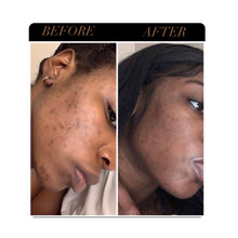 Load image into Gallery viewer, Turmeric Glow Bar
